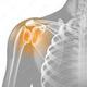 Medizinische 3D-Illustration – Schulterschmerzen Anatomie