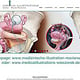 Neue Homepage nur für Medizinische Illustration