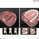 3D-Modelle für Patientenberatungssoftware, Quintessenz-Verlag, Berlin