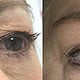 Microblading