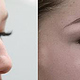 Microblading