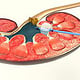 3D-Animation UROMED NEPHROquick Ballon-Katheter-Set