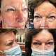 Microblading