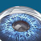 Augen-OP intraokulare Linse